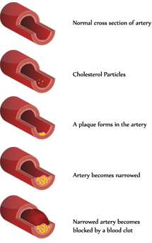 Stage of Clot Formation Image
